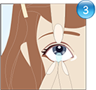Gently pinching lens to lift from eye surface